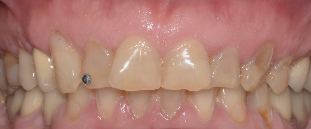 Before image alt