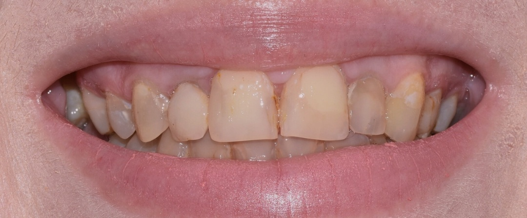 Before image alt