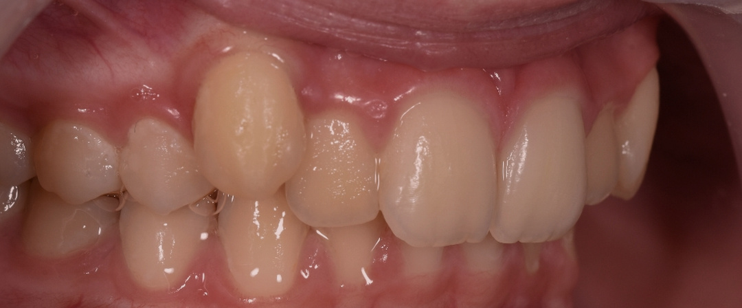 Before image alt