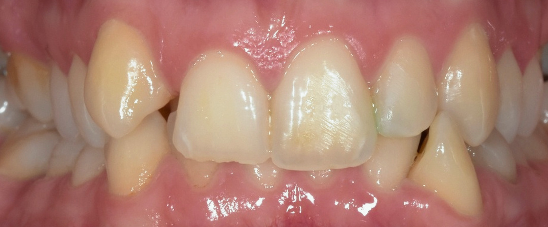 Before image alt