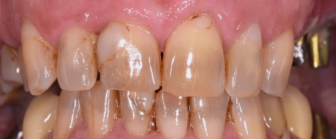 Before image alt